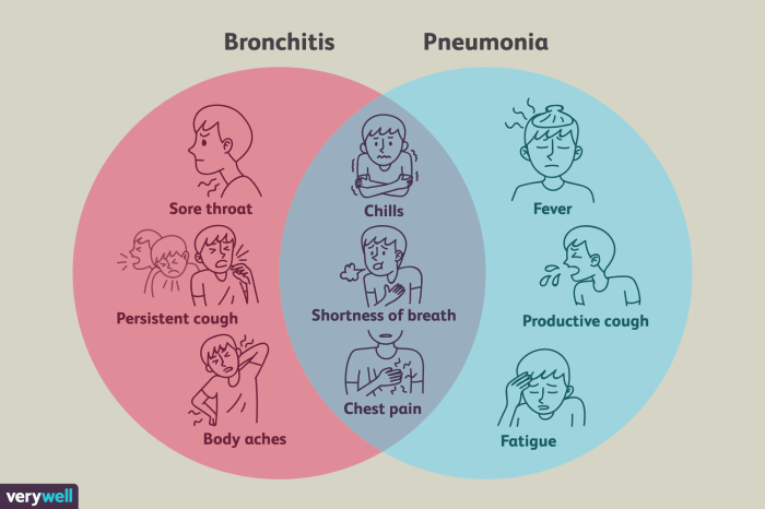 Do i have pneumonia or bronchitis quiz